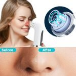 Rechargeable Electric Pore Blackhead Vacuum Cleaner_1